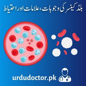 Blood-Cancer-Leukemia-Symptoms-in-Urdu-بلڈ-کینسر-کی-وجوہات-،علامات-اور-احتیاط