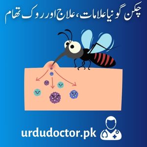 Chikungunya-Symptoms-in-Urdu-چکن-گونیا-علامات،-علاج-اور-روک-تھام