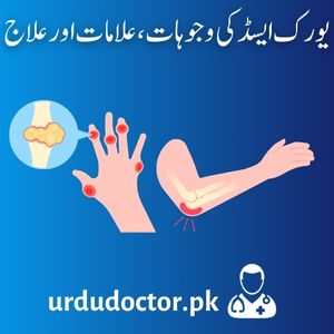 Uric-Acid-Symptoms-in-Urdu-یورک-ایسڈ-کی-وجوہات-،علامات-اور-علاج